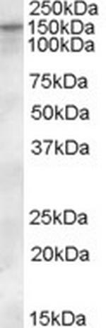 KCC1 Antibody in Western Blot (WB)