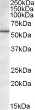 BAG5 Polyclonal Antibody