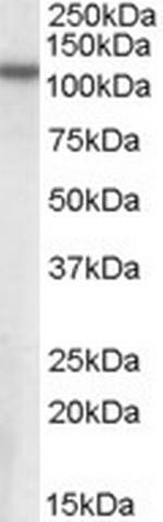 NPEPPS Polyclonal Antibody