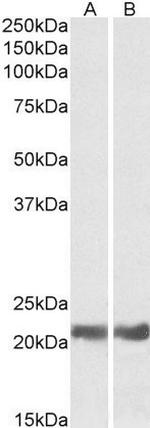 CRYAB Antibody in Western Blot (WB)