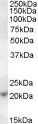 ASF1A Polyclonal Antibody