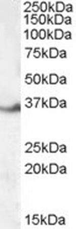 LASP1 Antibody in Western Blot (WB)