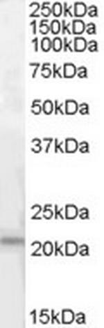 ARMET Polyclonal Antibody