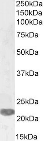PRRX1 Antibody in Western Blot (WB)