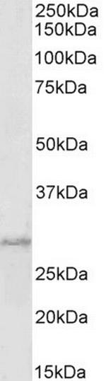 PRRX1 Antibody in Western Blot (WB)