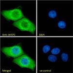 WISP1 Antibody in Immunocytochemistry (ICC/IF)