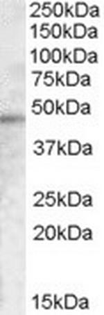 TMPRSS3 Polyclonal Antibody