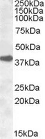 ERCC1 Polyclonal Antibody