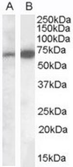 CADM4 Antibody in Western Blot (WB)