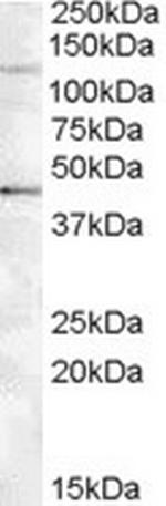 Tankyrase 2 Polyclonal Antibody