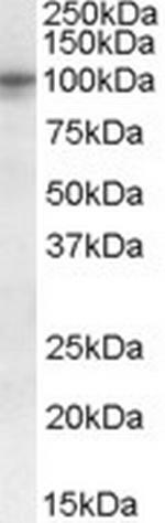 TAS1R2 Polyclonal Antibody