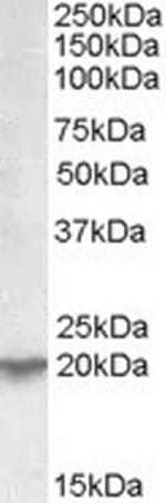 UXT Antibody in Western Blot (WB)