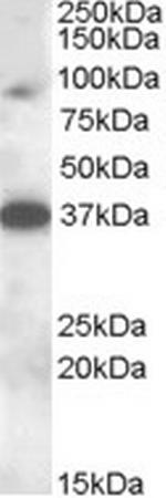 MARCH10 Antibody in Western Blot (WB)