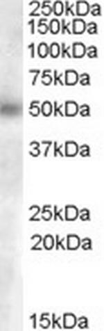 GCNT3 Polyclonal Antibody
