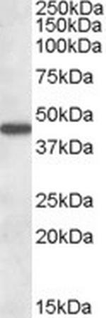 AADAT Polyclonal Antibody