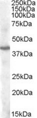 PITX3 Polyclonal Antibody