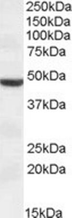 TMPRSS4 Polyclonal Antibody