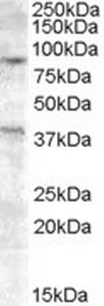 EXO1 Polyclonal Antibody