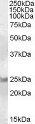 RAB8A Polyclonal Antibody