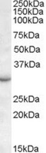 RAB23 Polyclonal Antibody
