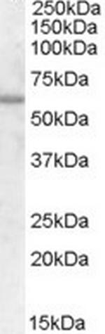 FZD7 Antibody in Western Blot (WB)