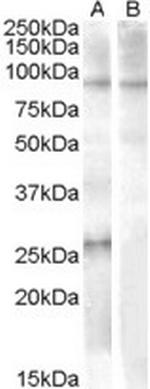 APOBEC2 Polyclonal Antibody
