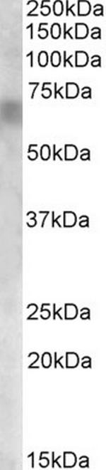 RPE65 Polyclonal Antibody