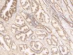 TUSC3 Antibody in Immunohistochemistry (Paraffin) (IHC (P))