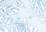 TUSC3 Antibody in Immunohistochemistry (Paraffin) (IHC (P))