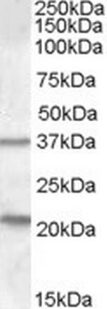 TUSC3 Antibody in Western Blot (WB)