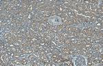 PNPLA3 Antibody in Immunohistochemistry (Paraffin) (IHC (P))