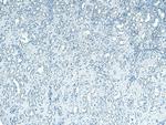 PNPLA3 Antibody in Immunohistochemistry (Paraffin) (IHC (P))
