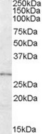 LYPLAL1 Polyclonal Antibody