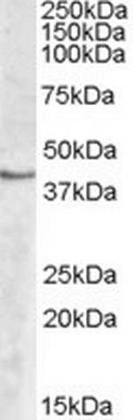 SPHK1 Polyclonal Antibody
