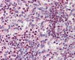 PU.1 Antibody in Immunohistochemistry (Paraffin) (IHC (P))