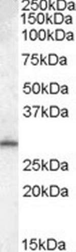 MTHFD2L Polyclonal Antibody