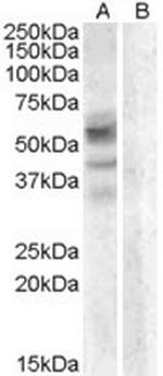 Arylsulfatase D Polyclonal Antibody