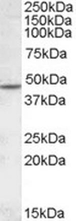 CHRNB2 Antibody in Western Blot (WB)