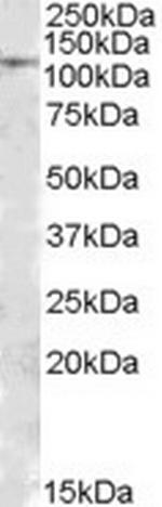 MTHFD1 Antibody in Western Blot (WB)