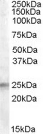 IGFBP6 Antibody in Western Blot (WB)