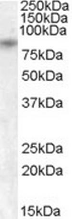 TRPV5 Polyclonal Antibody