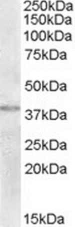 TXNDC6 Polyclonal Antibody