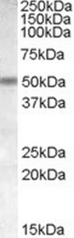 CHRNB3 Antibody in Western Blot (WB)
