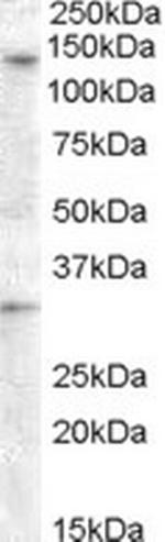 GPR125 Antibody in Western Blot (WB)