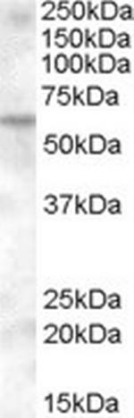 KPNA6 Antibody in Western Blot (WB)