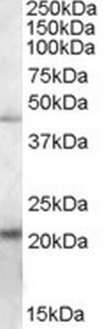ERP44 Polyclonal Antibody