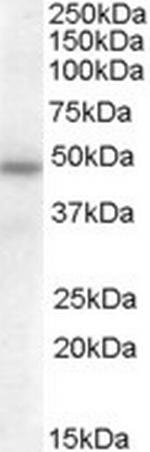 SERPINA12 Polyclonal Antibody