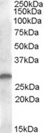 CLEC1B Polyclonal Antibody