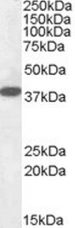 EPM2A Antibody in Western Blot (WB)
