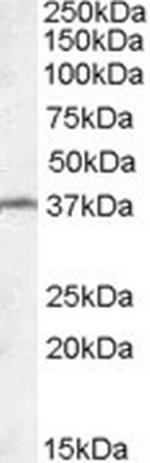 TSGA2 Polyclonal Antibody